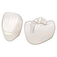 オールセラミック