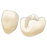 ハイブリッドセラミック