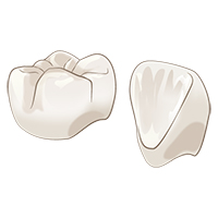 ジルコニアセラミック