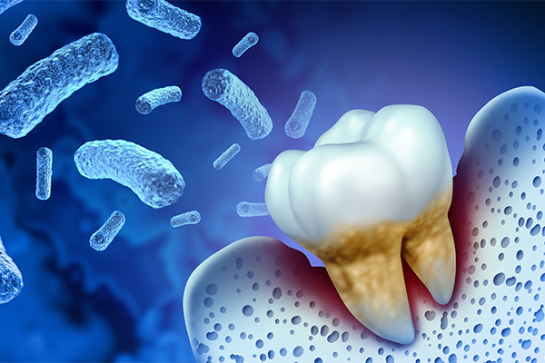当院が導入した予防システム
