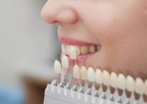 ホワイトニングで笑顔の第一印象アップ