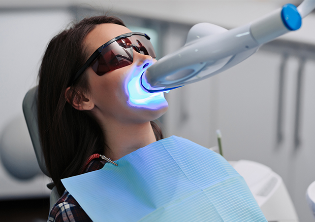 ティオン・オフィス（オフィスホワイトニング）